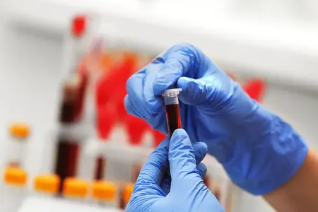 Брзо откривање маларија: комплетот за тест со двоен антиген на BABIO го зајакнува глобалното здравје